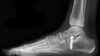 Nichts für Heimwerker!